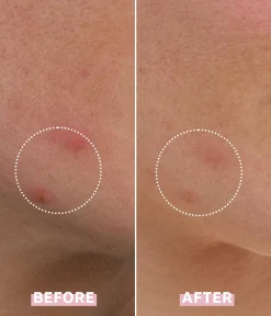 Best CAIA Cosmetics OH MY CICA SPOT GEL CREAM